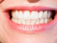 علت اصلی و علامت مهم پوسیدگی دندان