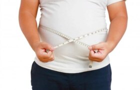 چاقی و ریزش مو ربطی بهم دارند؟