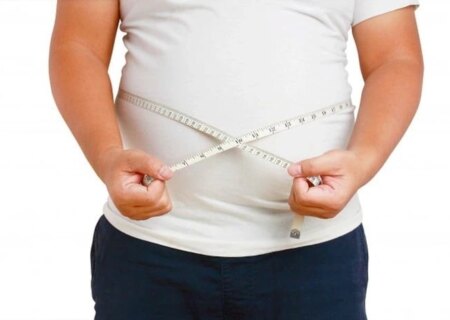 چاقی و ریزش مو ربطی بهم دارند؟